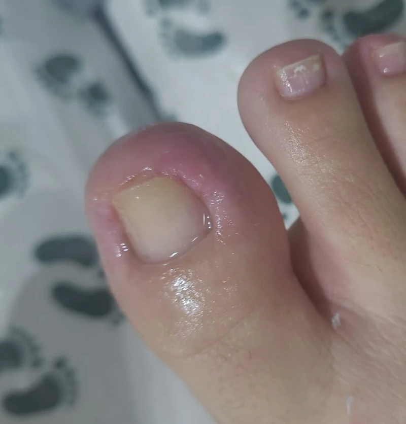 Consultório de podologia especializada