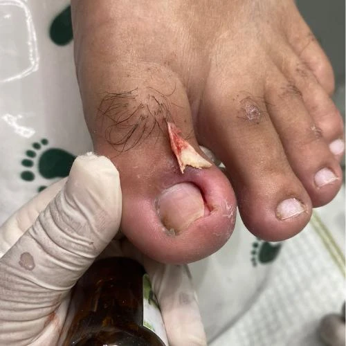 Podologia perto de mim