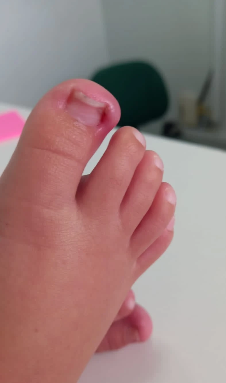 Podólogo perto de mim