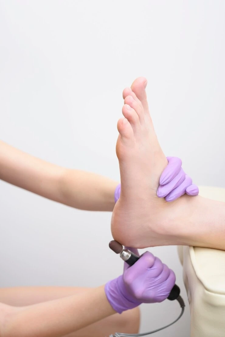 Tratamento para fissuras nos pés